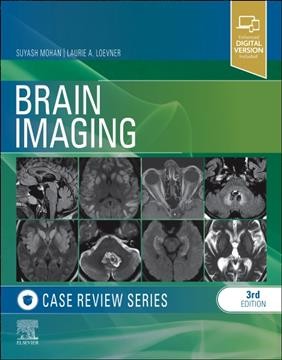 Brain imaging / Suyash Mohan, Laurie A. Loevner.